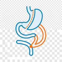 Bipartición intestinal SASI